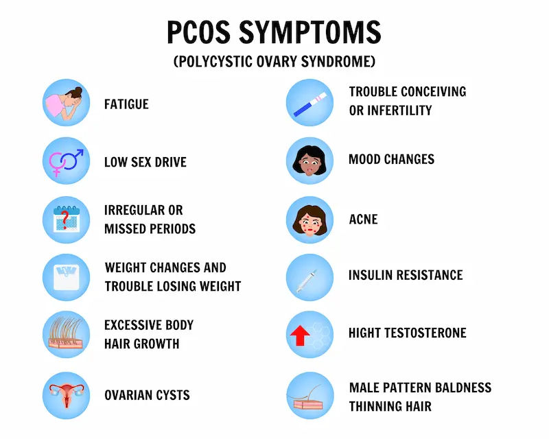 PCOS and Infertility A Guide for Successful Conception